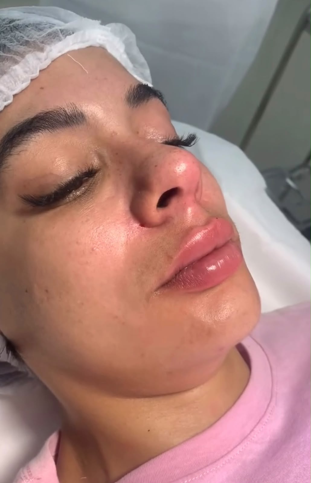 Atendimento facial na Estética Dreams